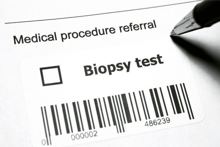 Biopsy Test