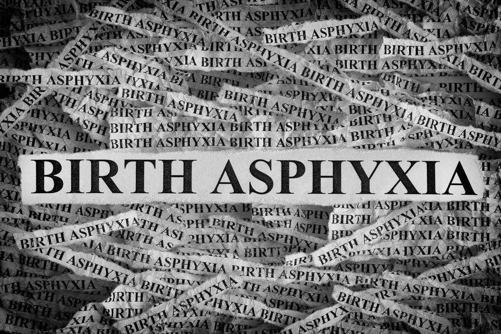 birth asphyxia