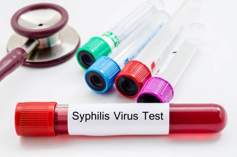 Syphilis virus test image