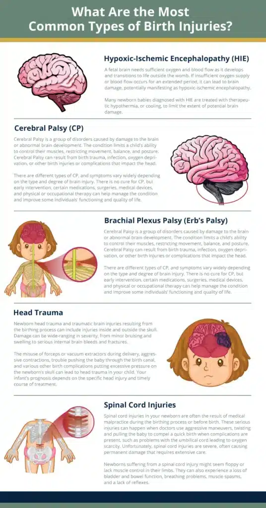 Most common types of birth injuries infographic
