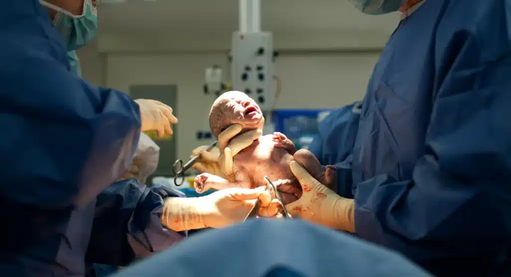 Medical team in surgical scrubs holding a baby trying to cut the umblical cord in an operating room