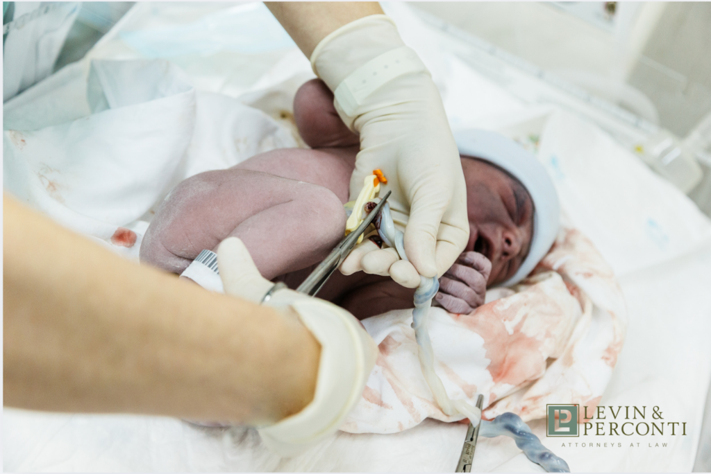 NICU nurse cutting umbilical cord